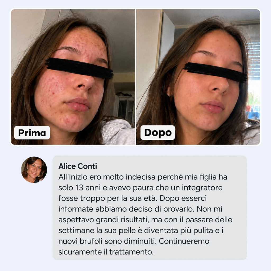 Di' addio ad acne e brufoli, e torna a sentirti finalmente sicura di te