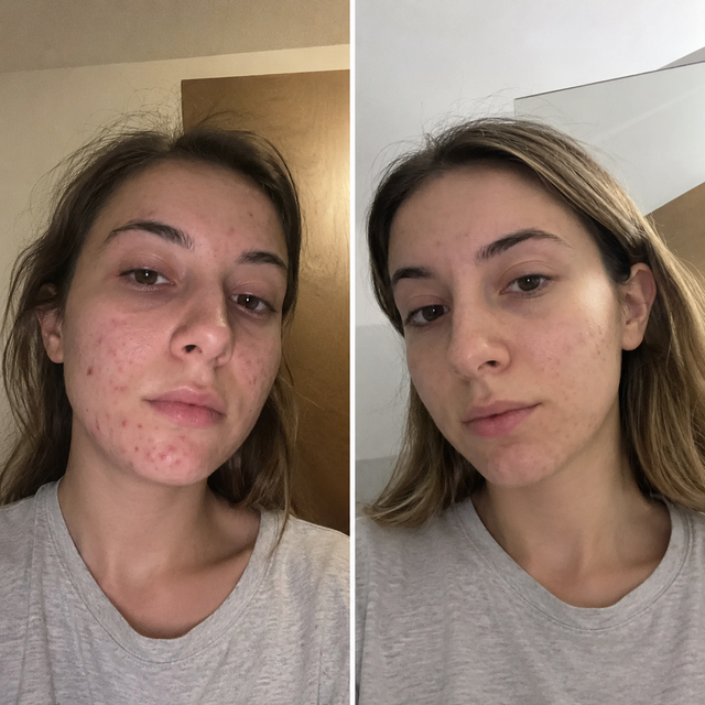 Foto prima e dopo