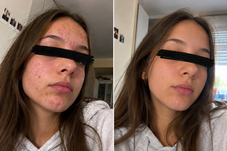 Foto prima e dopo