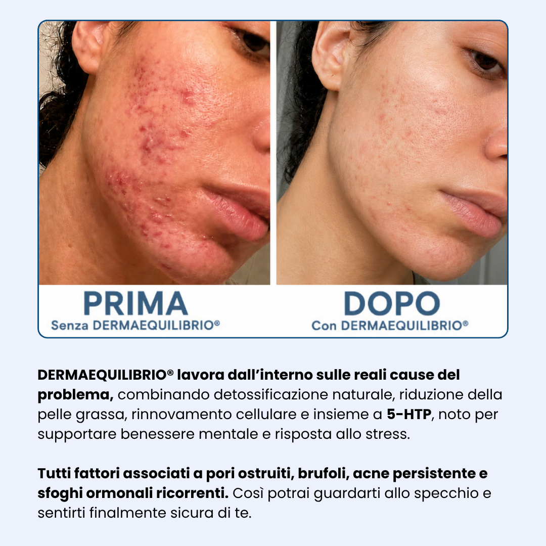 Di' addio ad acne e brufoli, e torna a sentirti finalmente sicura di te
