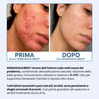 Di' addio ad acne e brufoli, e torna a sentirti finalmente sicura di te