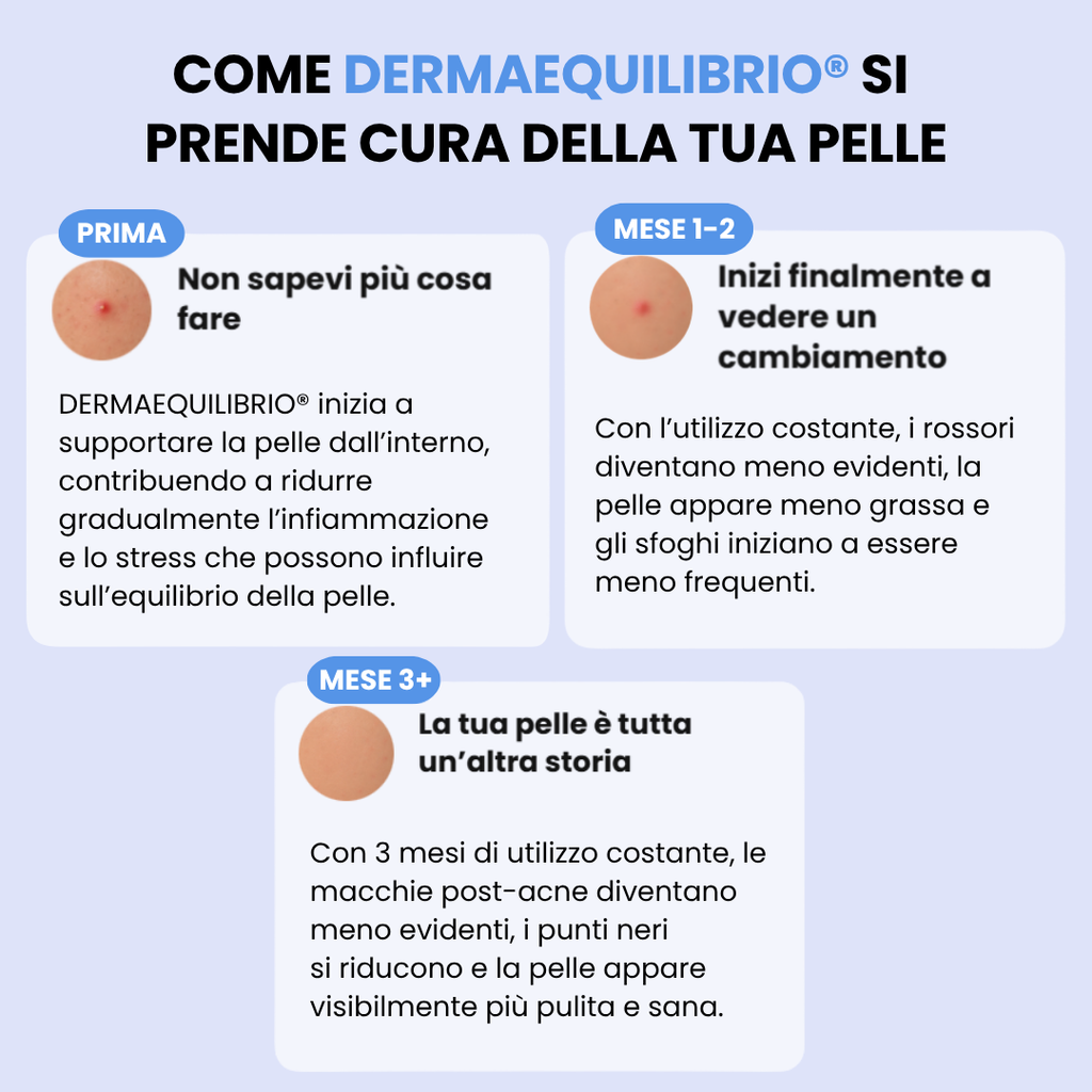 Di' addio ad acne e brufoli, e torna a sentirti finalmente sicura di te
